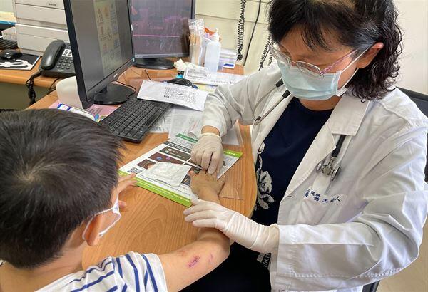 異位性皮膚炎搔癢抓破皮，害細菌感染！補充益生菌、維他命D有助改善